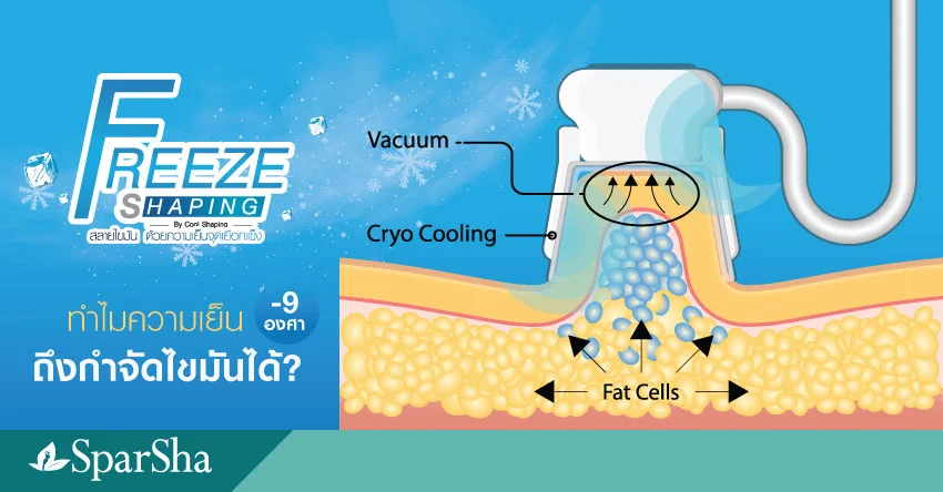 Freeze Shaping by Cool Shaping ทำไมความเย็นถึงกำจัดไขมันได้