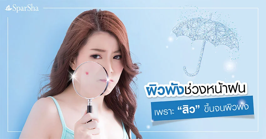 ผิวพังช่วงหน้าฝน เพราะสิวขึ้นจนผิวถูกพัง
