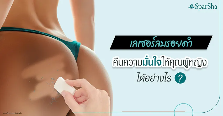 เลเซอร์ลบรอยดำ คืนความมั่นใจให้คุณผู้หญิงได้อย่างไร