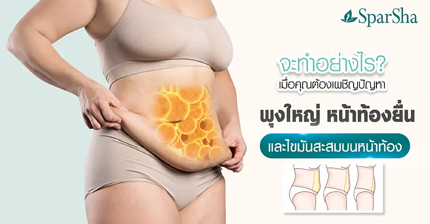 เมื่อเผชิญปัญหาพุงใหญ่ หน้าท้องยื่น และไขมันสะสมบนหน้าท้อง จะทำอย่างไร?