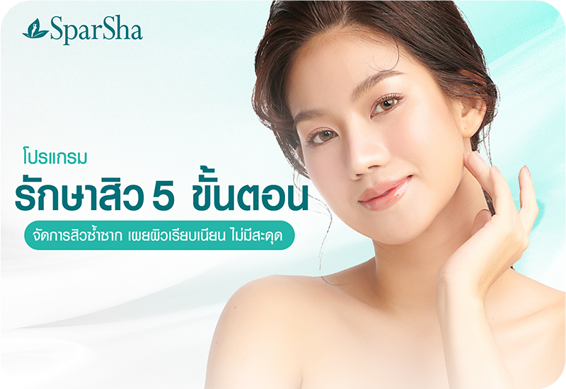 หมดกังวลเรื่องสิว เปลี่ยนผิวให้เนียนใส ด้วยโปรแกรมรักษาสิว 5 ขั้นตอน by SparSha