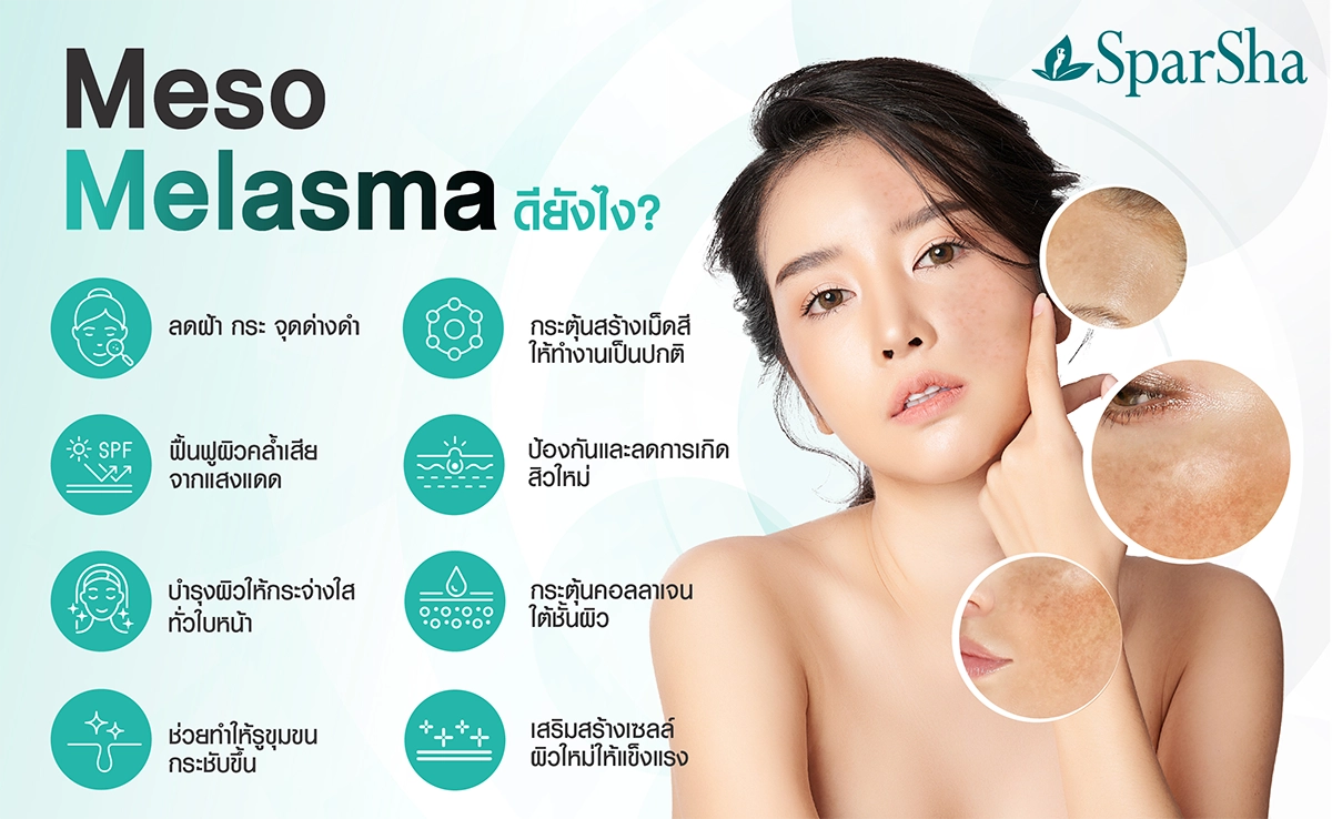 Meso Melasma โปรแกรมฉีดเมโสฝ้า กระ ลดเลือนจุดด่างดำ