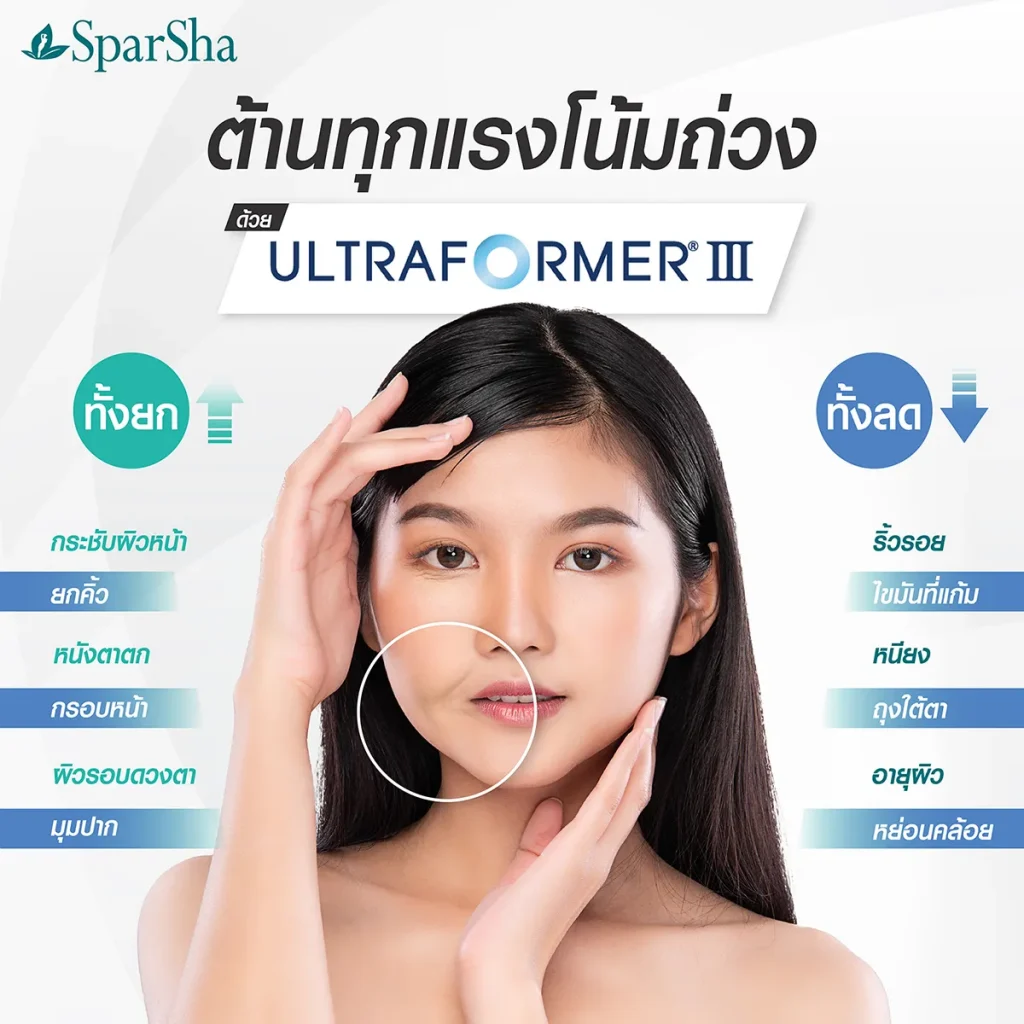 Ultraformer III นวัตกรรมยกกระชับหน้า