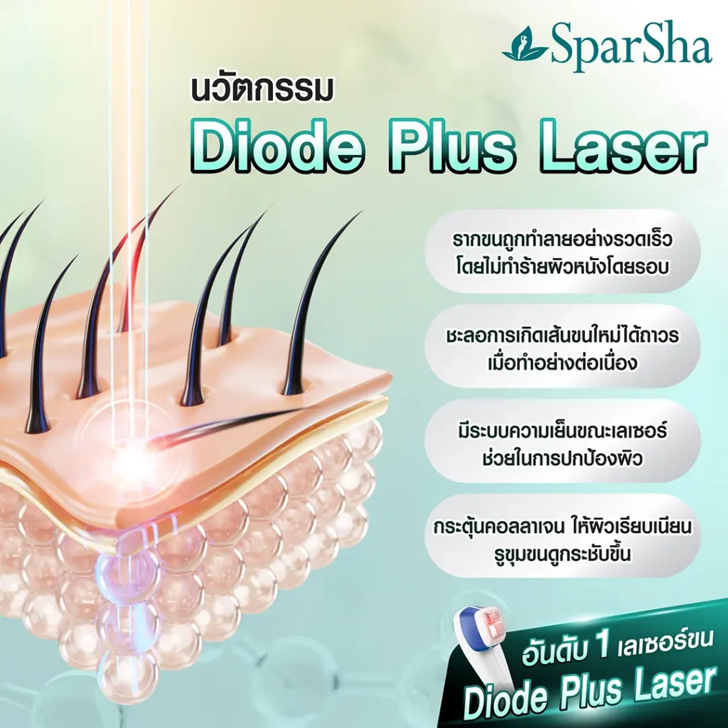 นวัตกรรม Diode Plus laser - sparsha