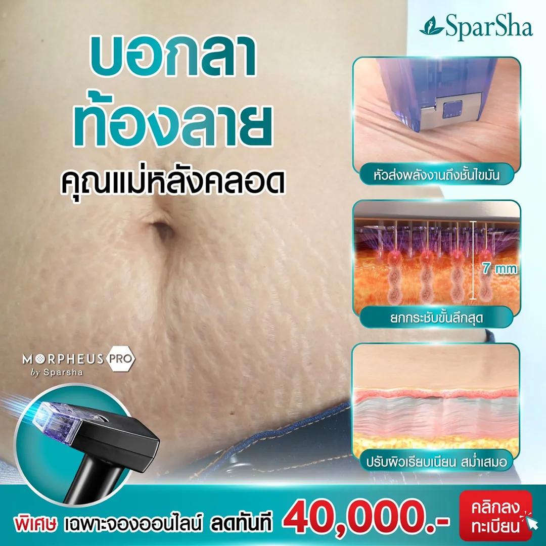 โบกมือลาตำแหน่ง คุณแม่ท้องลาย ด้วย Morpheus Pro เทคโนโลยีรีดผิวยับ ย่น เกลี่ยผิวแตกลาย