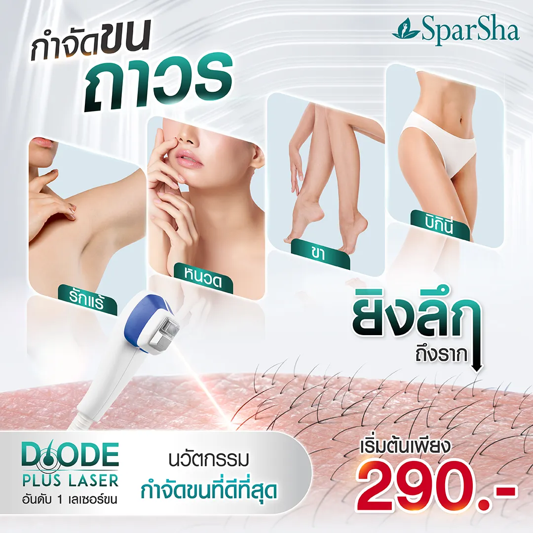 กำจัดขนถาวร ยิงลึกถึงราก นวัตกรรมกำจัดขน