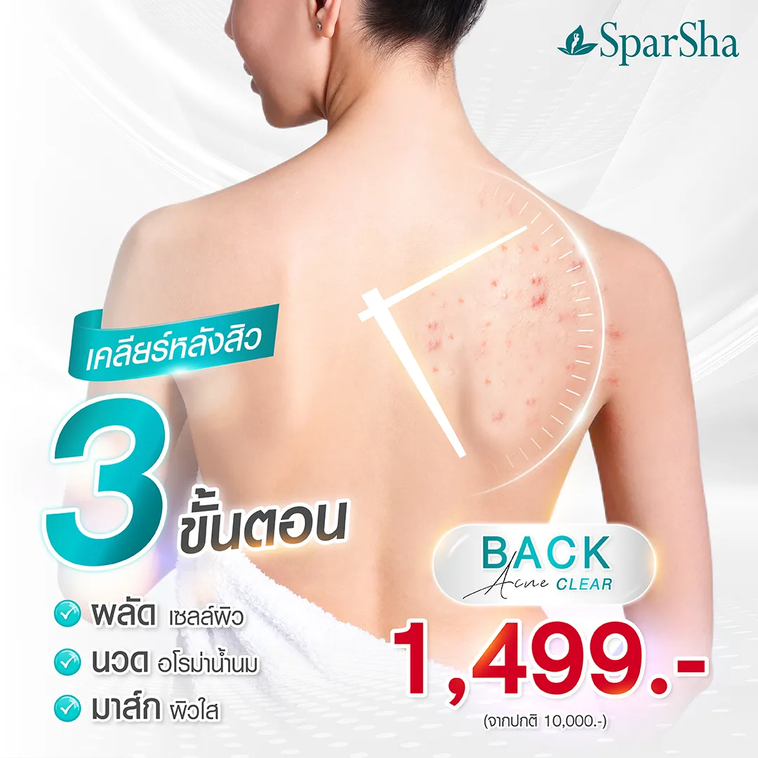 รักษาสิวที่หลัง สิวอักเสบ ลดสิว
