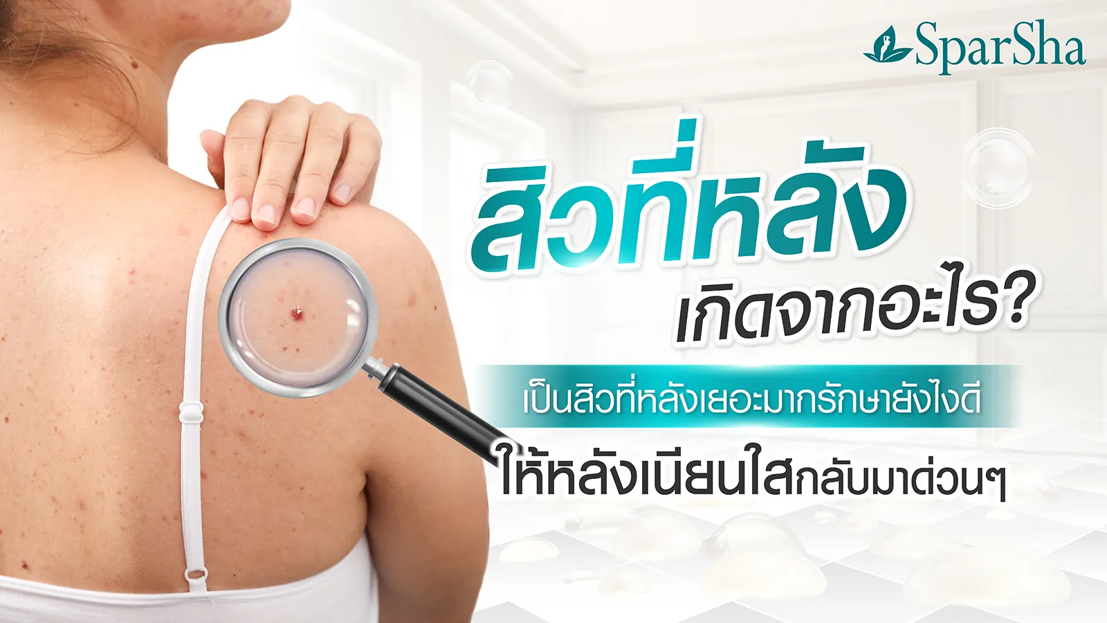 สิวที่หลัง เกิดจากอะไร