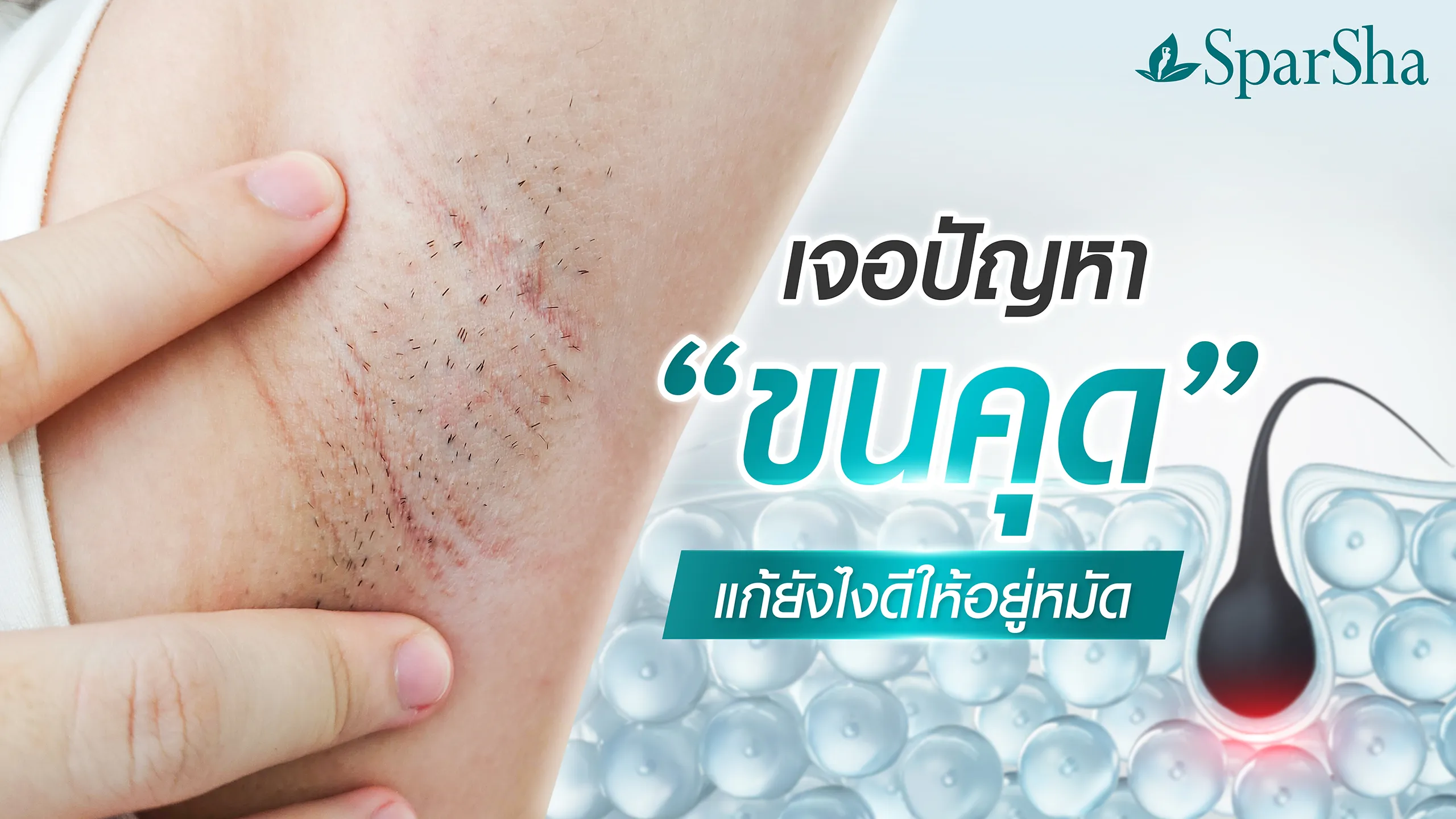 ขนคุด